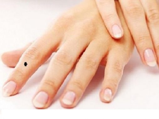 Xem bói nốt ruồi ở tay phụ nữ đoán biết vân mệnh sang hèn