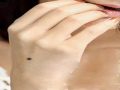 Ý nghĩa Nốt ruồi trên mu bàn tay ở đàn ông và phụ nữ?